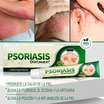 PSORIASIS?™ Crema Antifúngica y Antipicazón | 20g ☀️