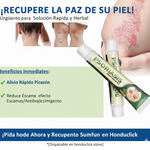 PSORIASIS?™ Crema Antifúngica y Antipicazón | 20g ☀️